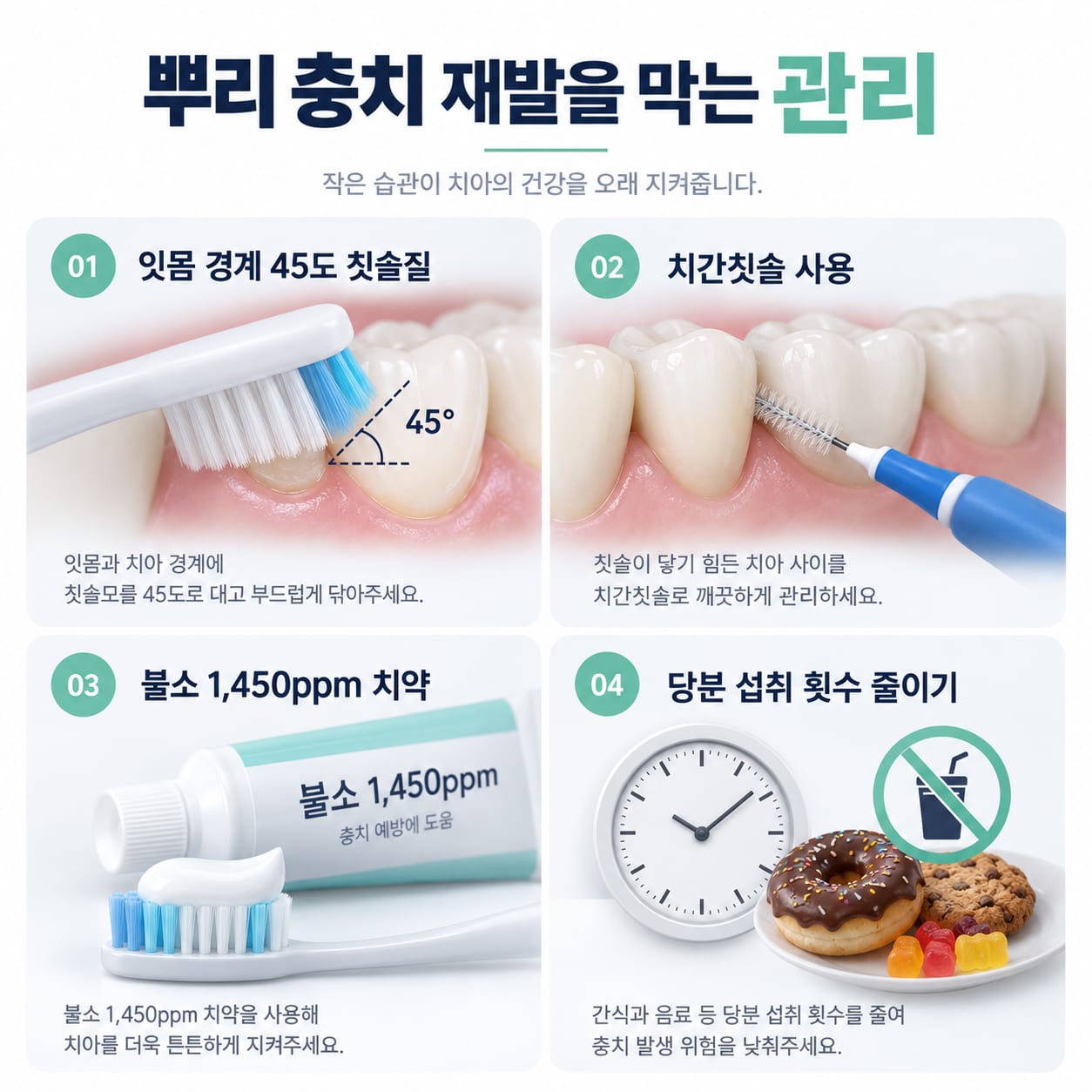 치간칫솔과 불소 치약을 이용한 치근 우식 재발 예방 관리법을 안내하는 그림