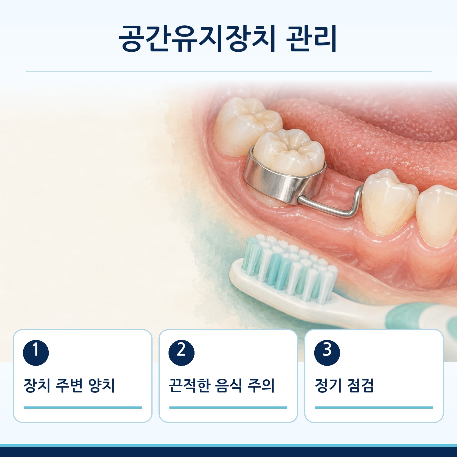 장치 주변 양치, 끈적한 음식 주의, 정기 점검 등 공간유지장치 관리 방법을 안내하는 그림